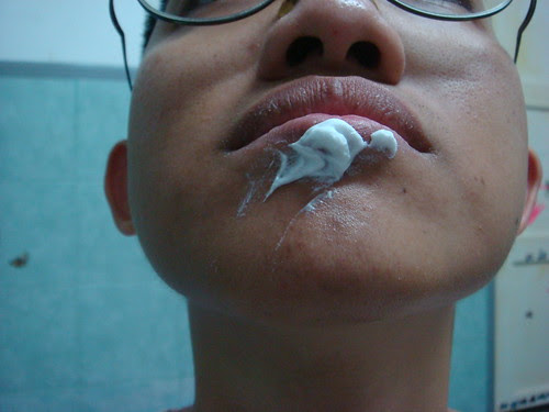 herpes simplex. Herpes simplex blisters