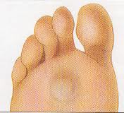 atrophy  fat  shoes Pad walkEZstore.com Whatâs Fat  pad for Atrophy: That?