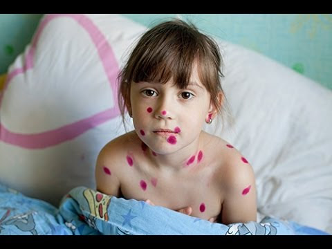 Le traitement mdical des hmorrodes