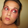 pink eye