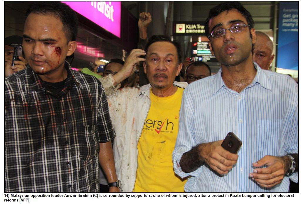 Image result for gambar Anwar Ibrahim masuk hospital kena tear gas