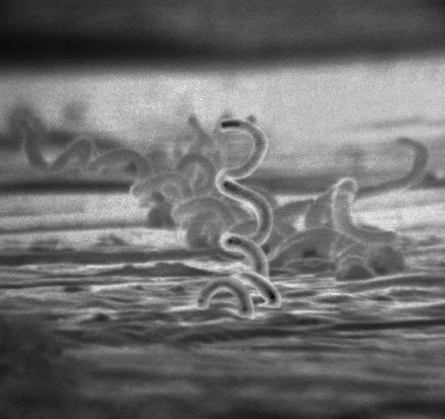 急増する梅毒感染者 過去最速ペース 把握しておきたいhiv感染との関係 Newsphere