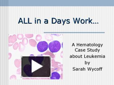 haematological case study