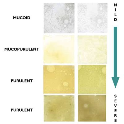  copd sputum colour chart phlegm color chart hereqfile copd phlegm