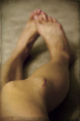 knee swelling