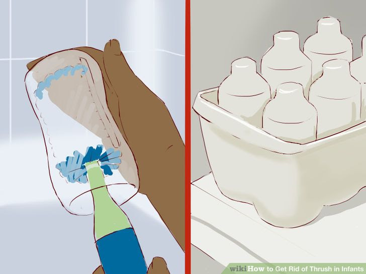 Get Rid of Thrush in Infants Step 15 Version 2.jpg