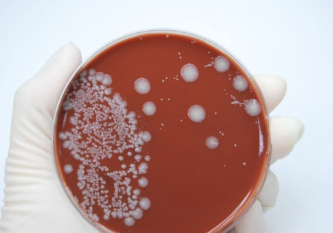common cold virus structure. hair The common cold virus