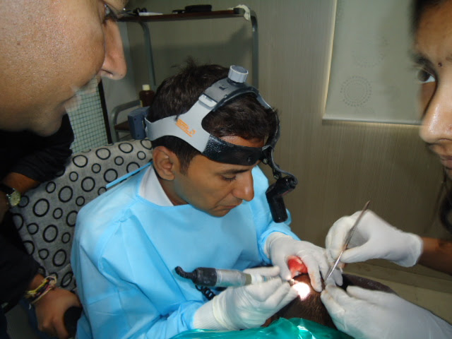 Hair Transplant Delhi NCR