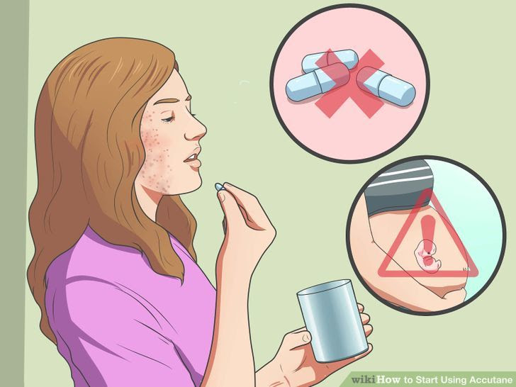 Start Using Accutane Step 15.jpg