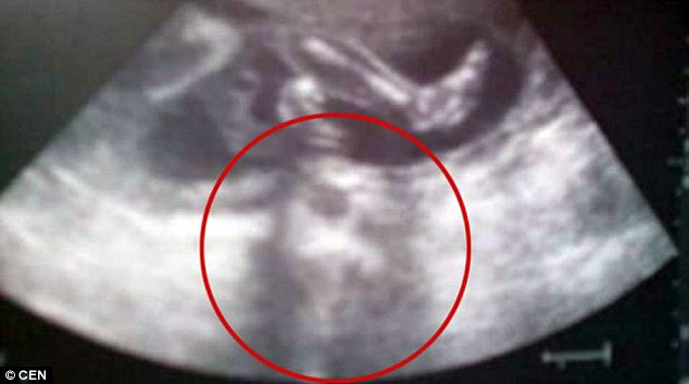 The photo, which shows a facelike shadow below the baby, has since been shared on social media where it has attracted some contradictary reactions