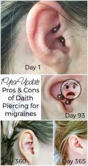 Her earring holes (which for as long as i . Migraine Piercing - 1 Year Results | Migraine piercing