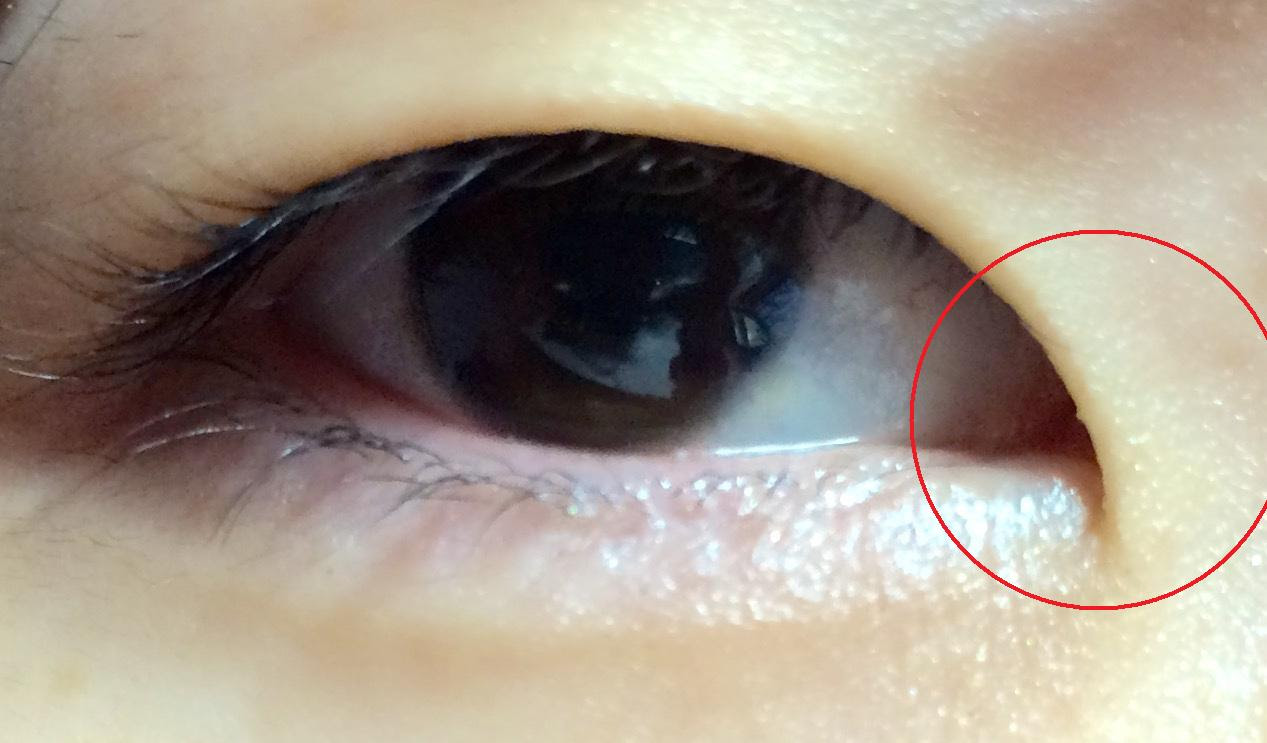 コンプレックス解消メイク メイク法 奥二重にするアイメイク 1 一重のしくみ
