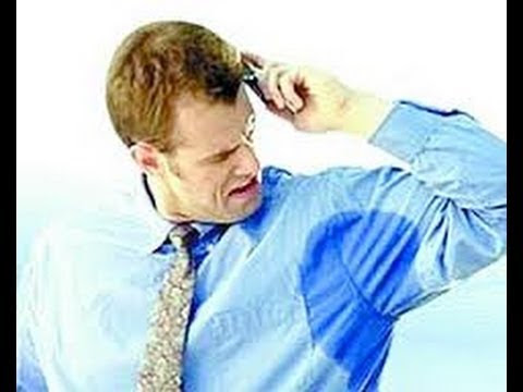 excessive sweating treatment.excessive sweating.excessive underarm 
