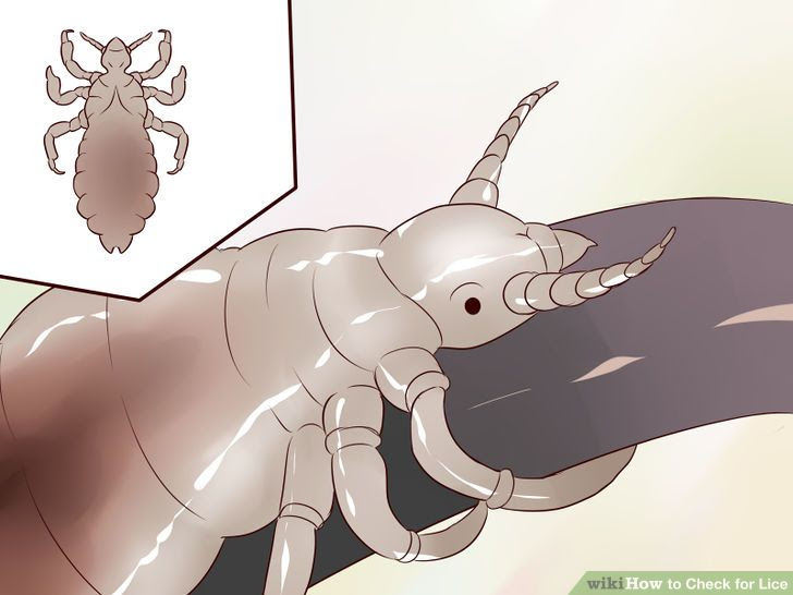 Check for Lice Step 6 Version 2.jpg