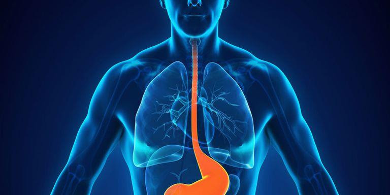 Nyelőcső daganat fiatalon