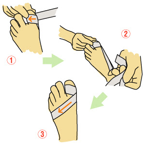 芸術家のくすり箱 自分でできるテーピング 2 外反母趾 動画解説