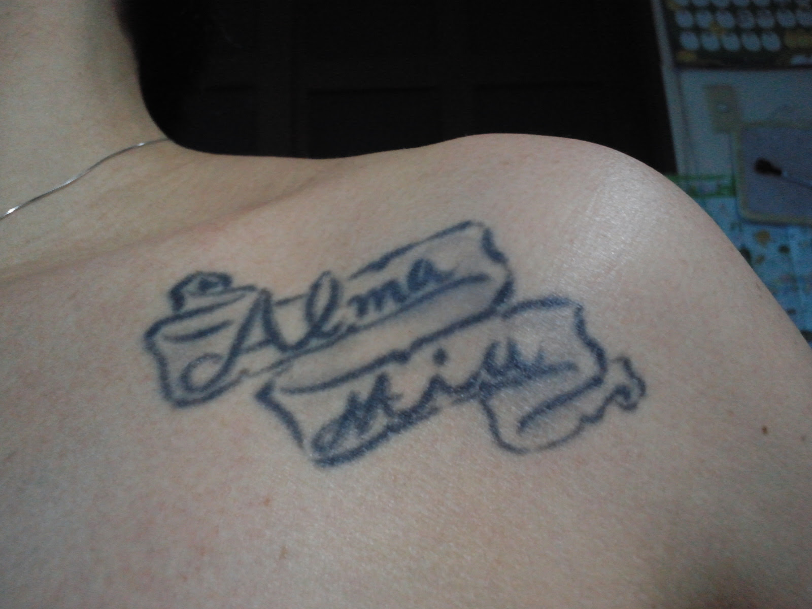 タトゥーが消えるまで その7 経過512日目 1年4ヶ月10日 Cinderellaの成長 楽天ブログ