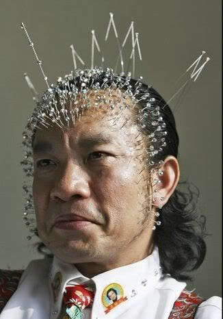 acupuncture chine