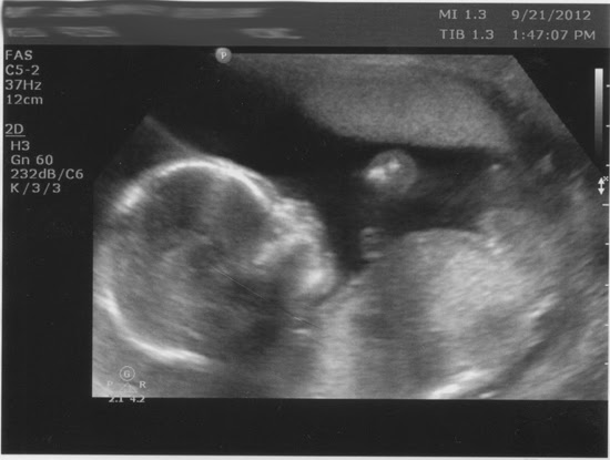 BabyJ_2_18WeeksB_Web