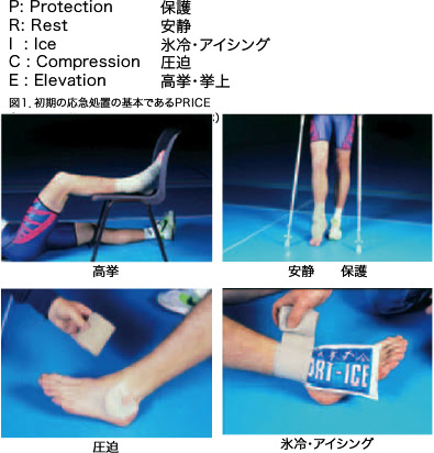 中 高校生のスポーツ選手に多い怪我 打撲