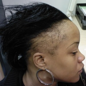 Beautiful Curls and Afros: Natural Hair and Thinning Edges