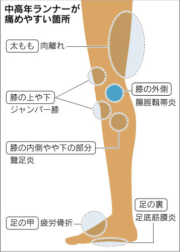 ランニングでの足の痛み 膝や筋肉の炎症 準備運動入念に 健康増進 病気予防 抗加齢 アンチエイジング 長寿 統合医療 ダイエット 競技力 豊かさ 幸せ探求 楽天ブログ