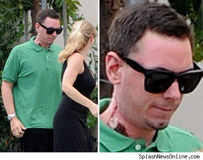 dj am injuries
