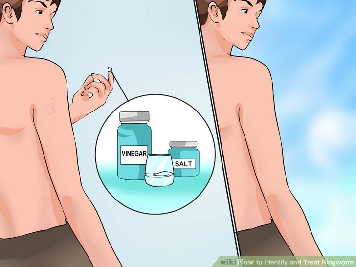 Identify and Treat Ringworm Step 11 Version 2.jpg