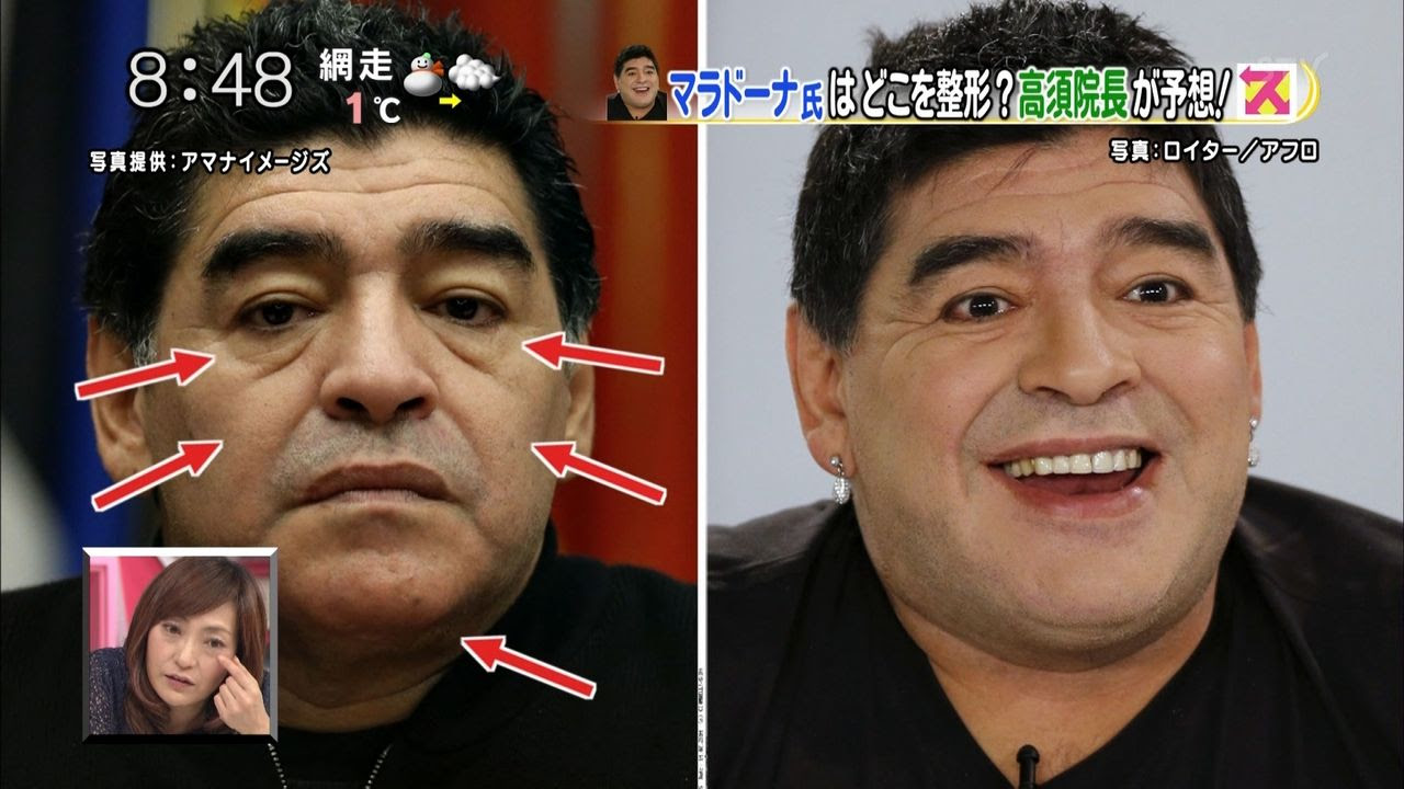 画像 美容整形手術で美しくなった元アルゼンチン代表マラドーナ氏 54 をご覧ください ２ｃｈみんなのまとめ