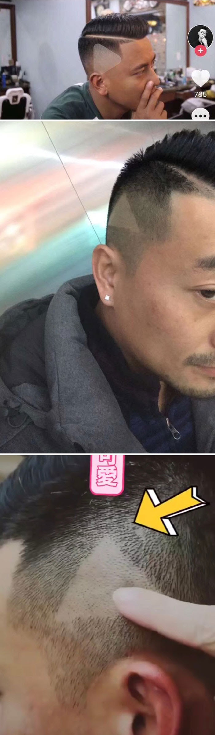 So This Guy Paused A Video Of A Model He Wanted To Look Like And His Barber Mistook The Play Button Icon With His Desired Hairstyle And Shaved Triangles On Both Sides Of His Head
