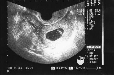 赤ちゃんに会えるまで 妊娠 出産のキオク