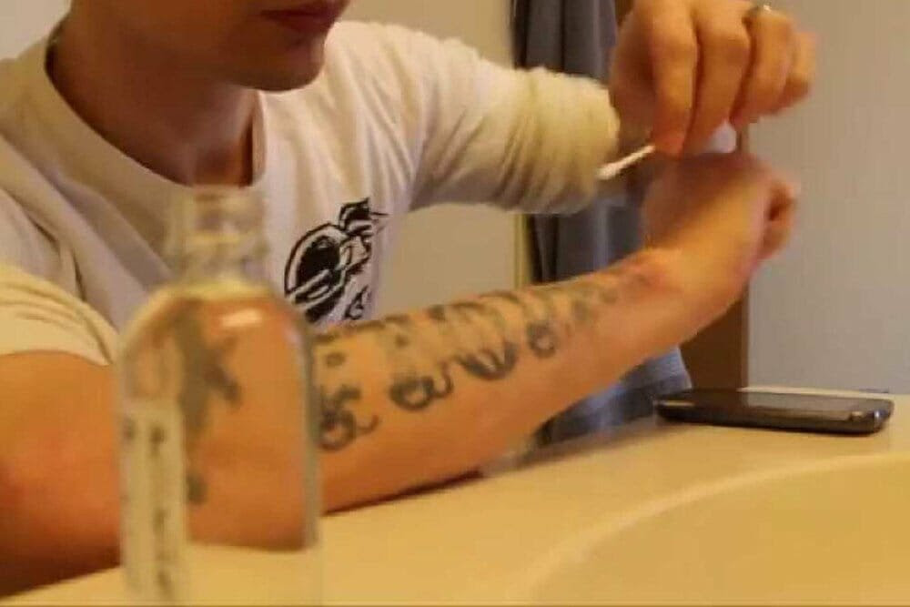 Acido removador de tatuagem funciona Peelings Quimicos Para Remocao De Tatuagem E Eficaz