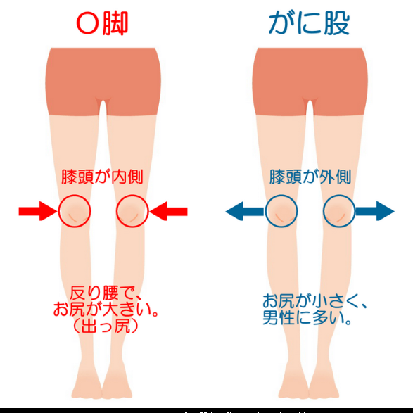 若い女性で O脚になっている 悩みが解消しました 株式会社conditioning Bridge