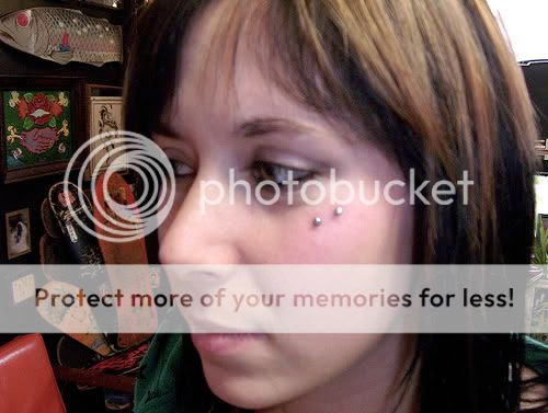 How long did it take to heal?