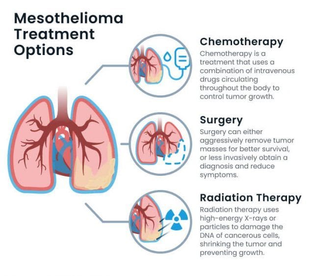 Mesothelioma Disease Treatment / What Happens In The Final Stages Of Mesothelioma Pintas Mullins Law Firm / Maybe you would like to learn more about one of these?