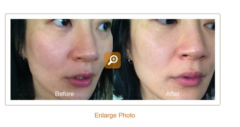 NEW VITAMIN C SUPPLEMENT BEFORE AND AFTER | vitamin c