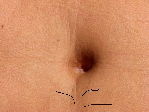 Mi Panza Tiene 3 Pelos Y Otros Danos Colaterales Del Embarazo