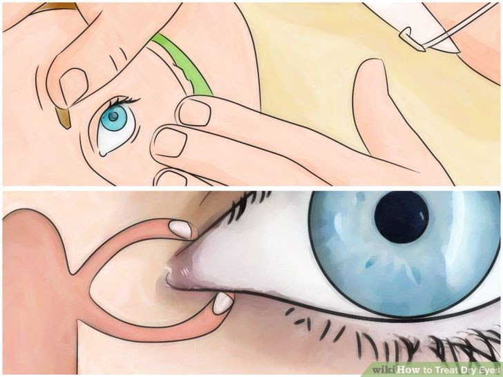 Treat Dry Eyes Step 7.jpg