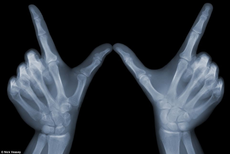 Whatever: A pair of hands make the taunting playground gesture with the two thumbs pressed together and the first figures vertical to give the W shape