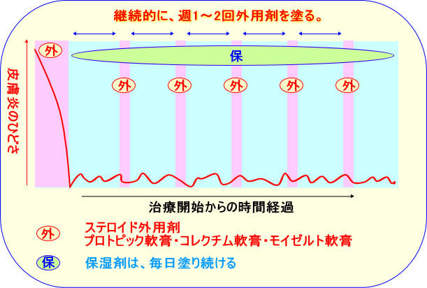 ステロイド外用剤の上手な使い方