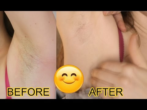 VIDEO : philips lumea  ipl  review - permanent at home hair removal that works! [not sponsored] - pics - ipdate: made an amazon associates account so i can earn some extra if anyone wants toipdate: made an amazon associates account so i c ...