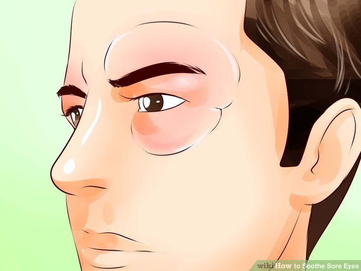 Soothe Sore Eyes Step 20.jpg