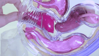 how do menstrual cups work