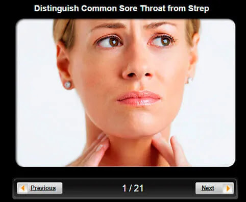  Throat Pictures Slideshow: Distinguish Common Sore Throat From Strep