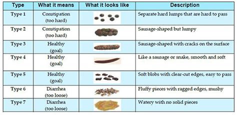 Weboct 8, 2022 · stool comes in a range of colors. what is the bristol stool chart adult human poop chart stool color