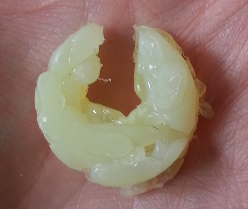 cone for cure the X)  Retainer  Cone Foreskin (TLC/TLC Network / Restoration Intactivism