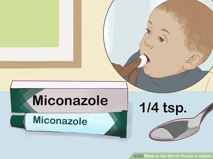 Get Rid of Thrush in Infants Step 8 Version 3.jpg