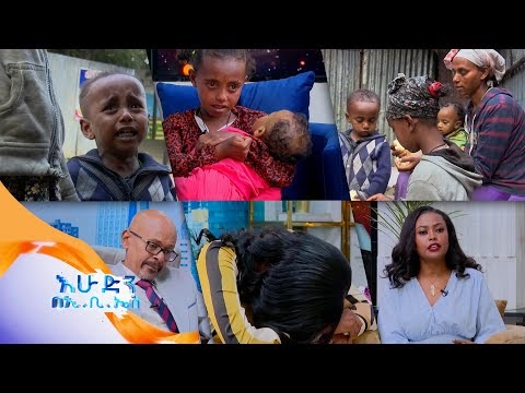 A nine-year-old girl who raises her two-year-old brother by begging