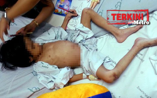 Ibu Tiri Bapa, Suspek Kes Dera Kanak-Kanak Perempuan Ditahan