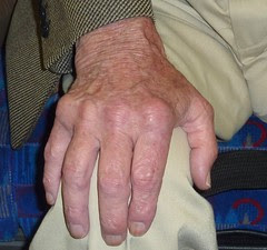 A hand that "lived and worked" by Julie70